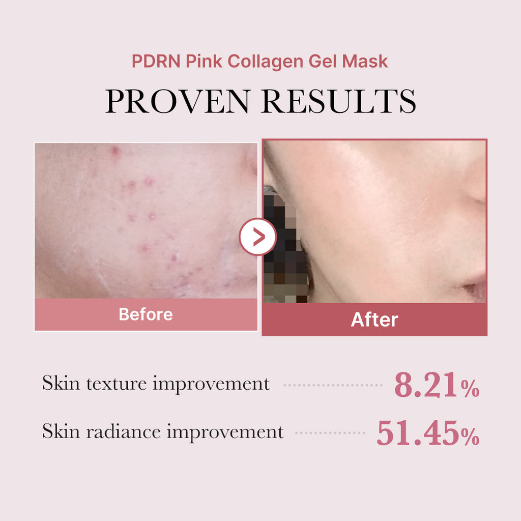 Mascarilla de Gel de Colágeno Rosa PDRN de Salmón Medicube 4EA