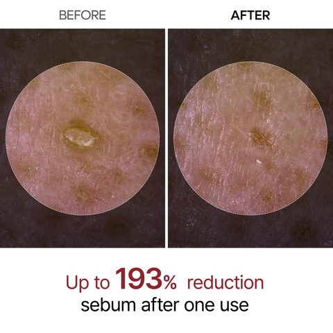 Dr.Melaxin Peel Shot Glow Black Rice Ampoule